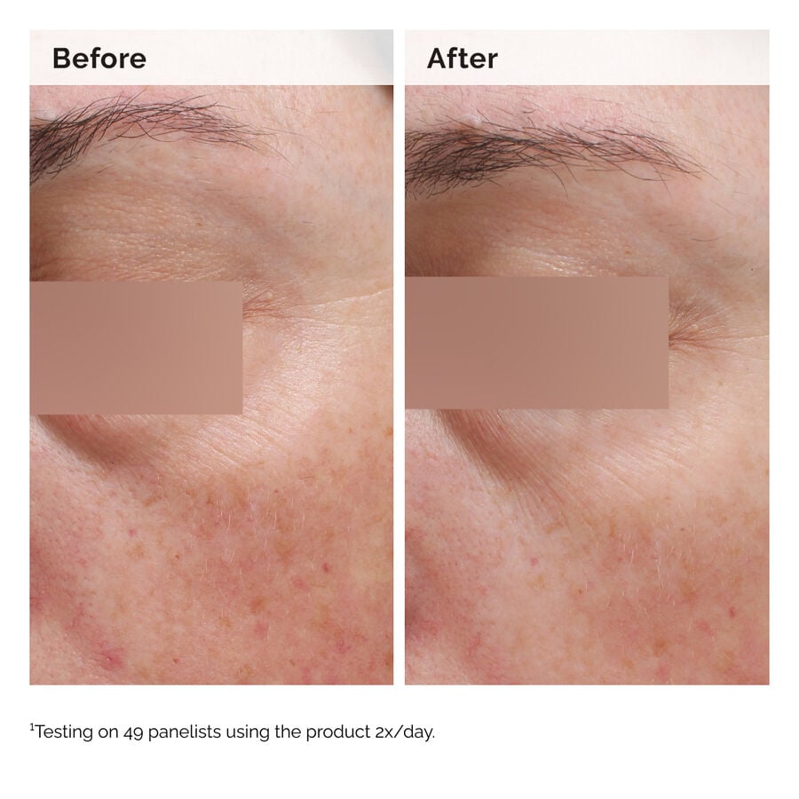 niacinamide-5-face-and-body-emulsion-q0 2024-08-23-ORD-Nia-5pct-Face-Body-B-A-Elasticity-Global-02-1x1.jpg