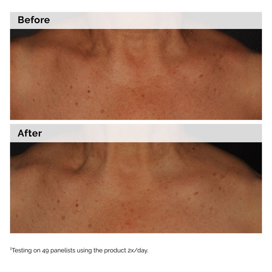 niacinamide-5-face-and-body-emulsion-q0 2024-08-23-ORD-Nia-5pct-Face-Body-B-A-Global-02-1x1.jpg
