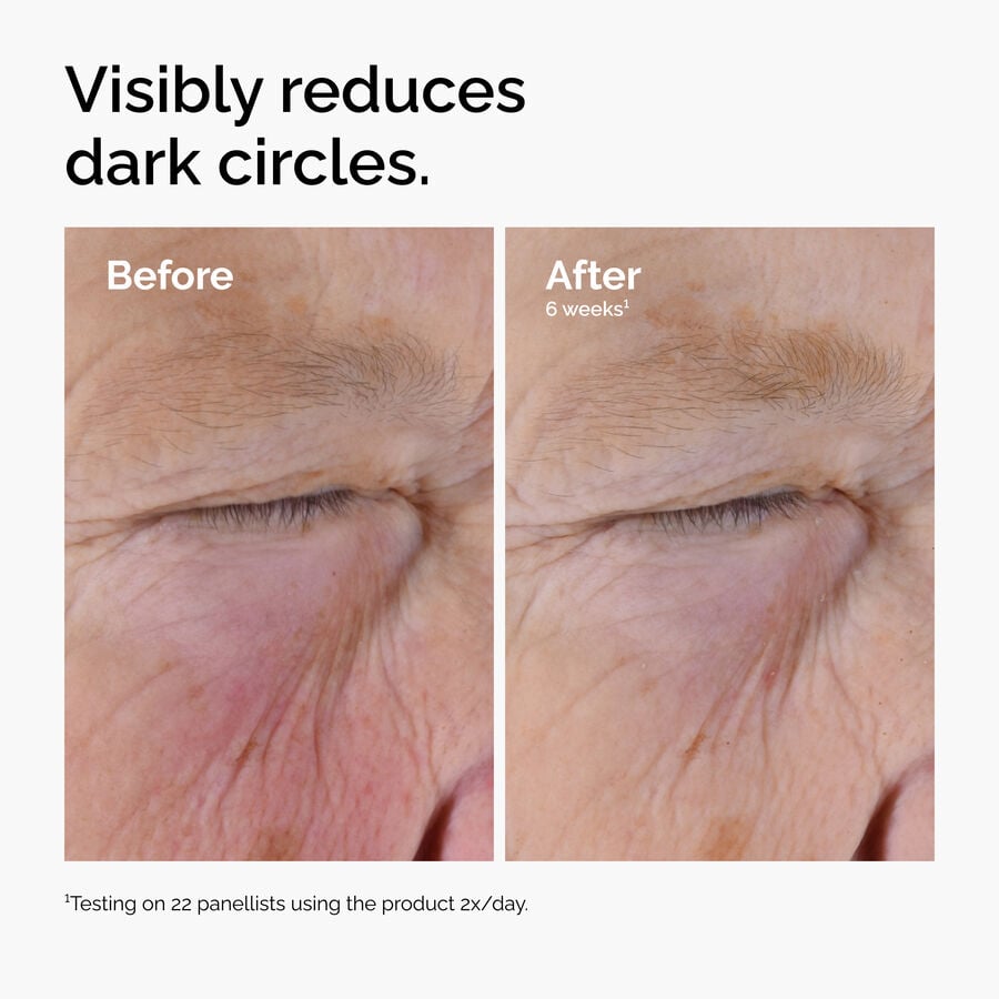 caffeine-solution-5-egcg-eye-serum-s8 ord-caffeine-solution-egcg-dark-circles-before-after.jpg