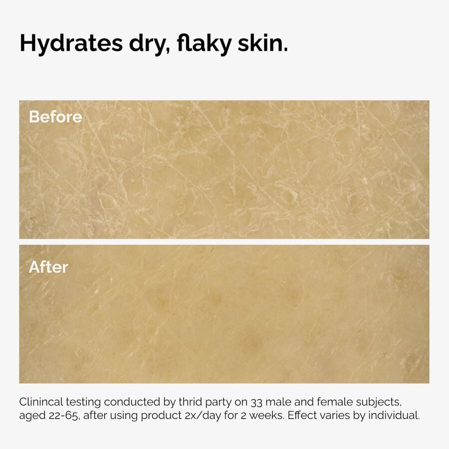 the-body-care-collection-d5 ord-natural-moisturizing-factors-inulin-body-before-after-graphic-02.jpg