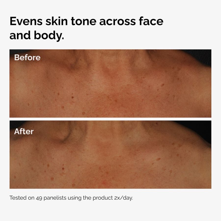 the-body-care-collection-d5 ord-niacinamide-face-body-serum-before-after-even-tone-graphic.jpg