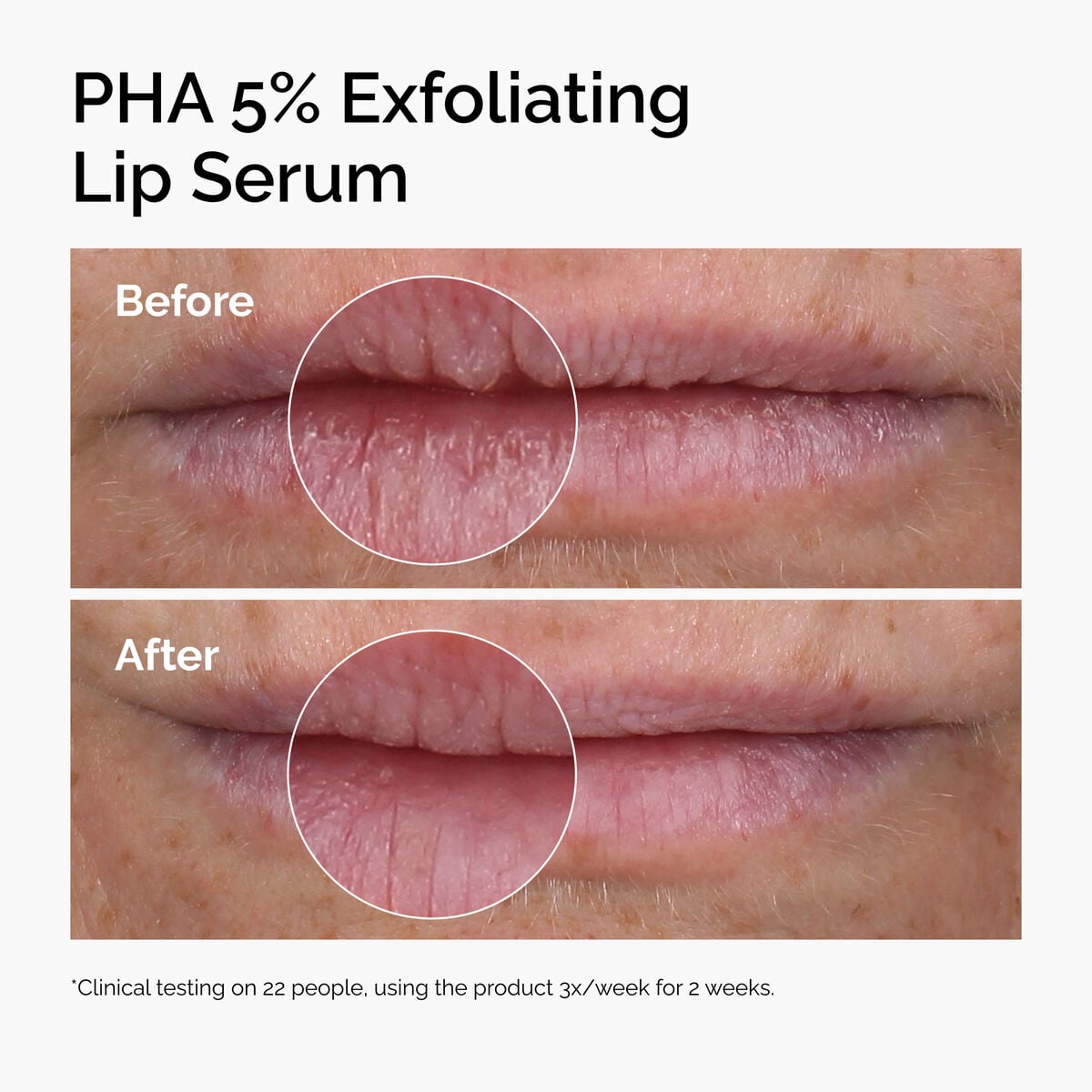 pha-5-exfoliating-lip-serum-b2 ord-pha-5pct-lip-exfoliating-serum-before-after.jpg