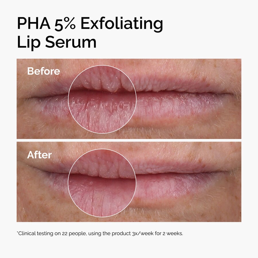 pha-5-exfoliating-lip-serum-b2 ord-pha-5pct-lip-exfoliating-serum-before-after.jpg